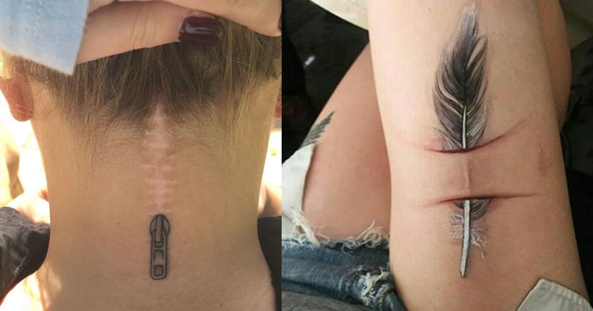 28 mensen die hun littekens hebben verwerkt in een tattoo